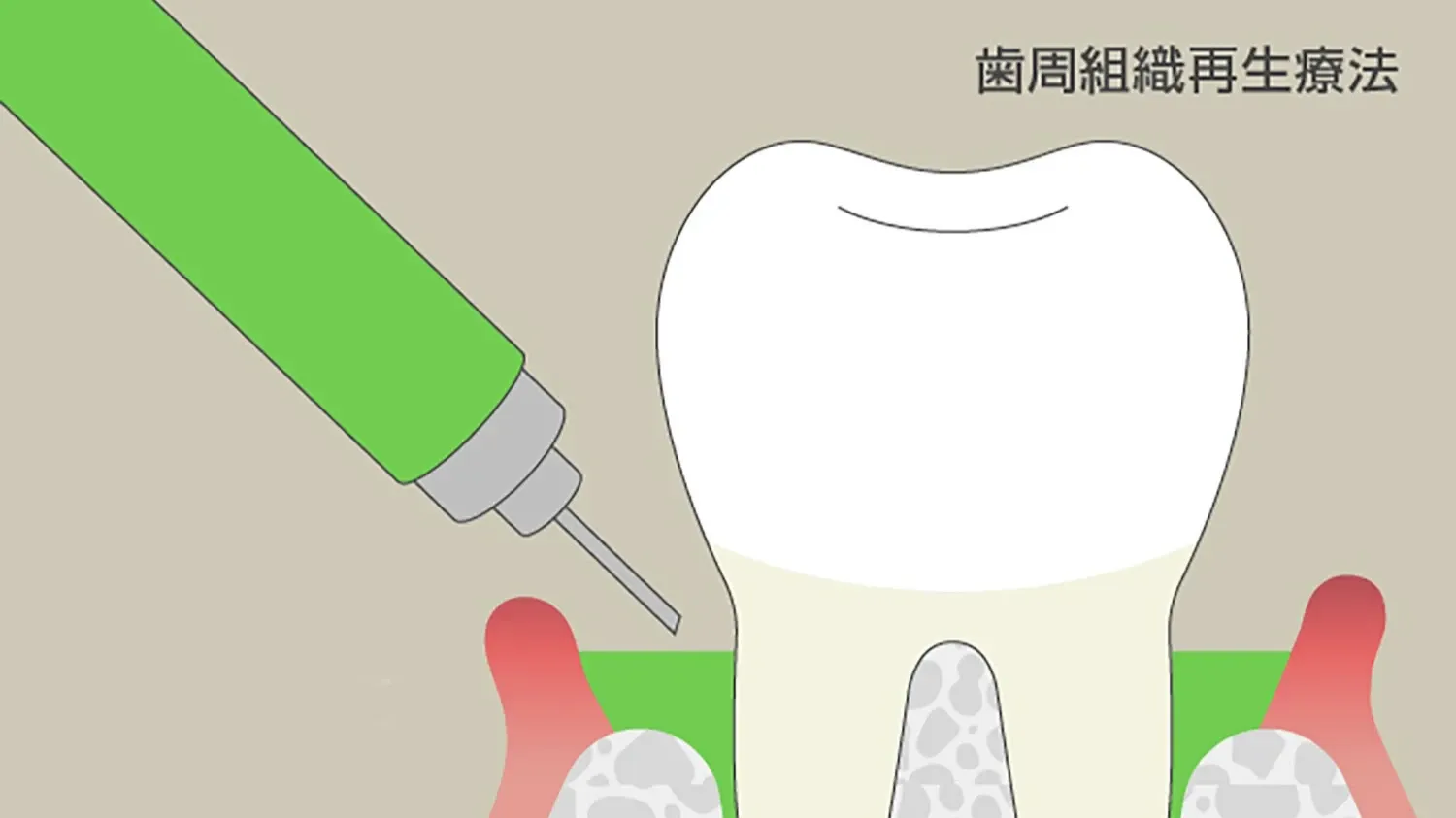再生療法への積極的対応